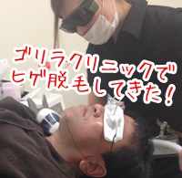 髭脱毛の口コミランキング メンズサロンのおすすめ