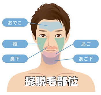 髭脱毛の口コミランキング メンズサロンのおすすめ
